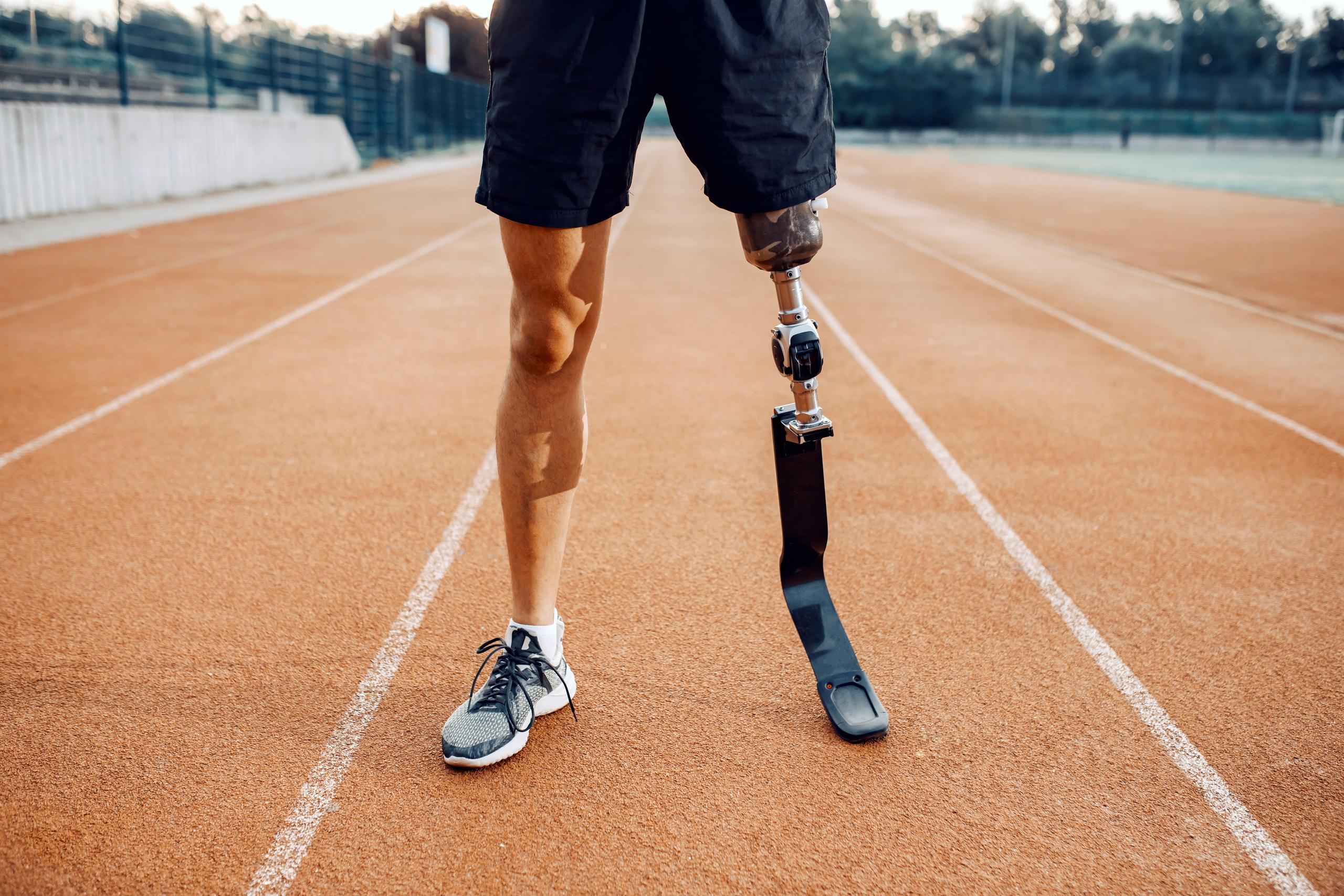 Close-up of a person with a prosthetic running leg standing on an outdoor track, symbolizing recovery, resilience, and adaptation after an amputation injury.