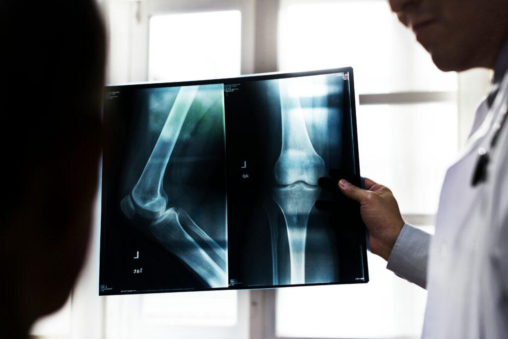 Doctor holding and examining X-ray images of a patient’s knee and elbow bones in a brightly lit medical office.