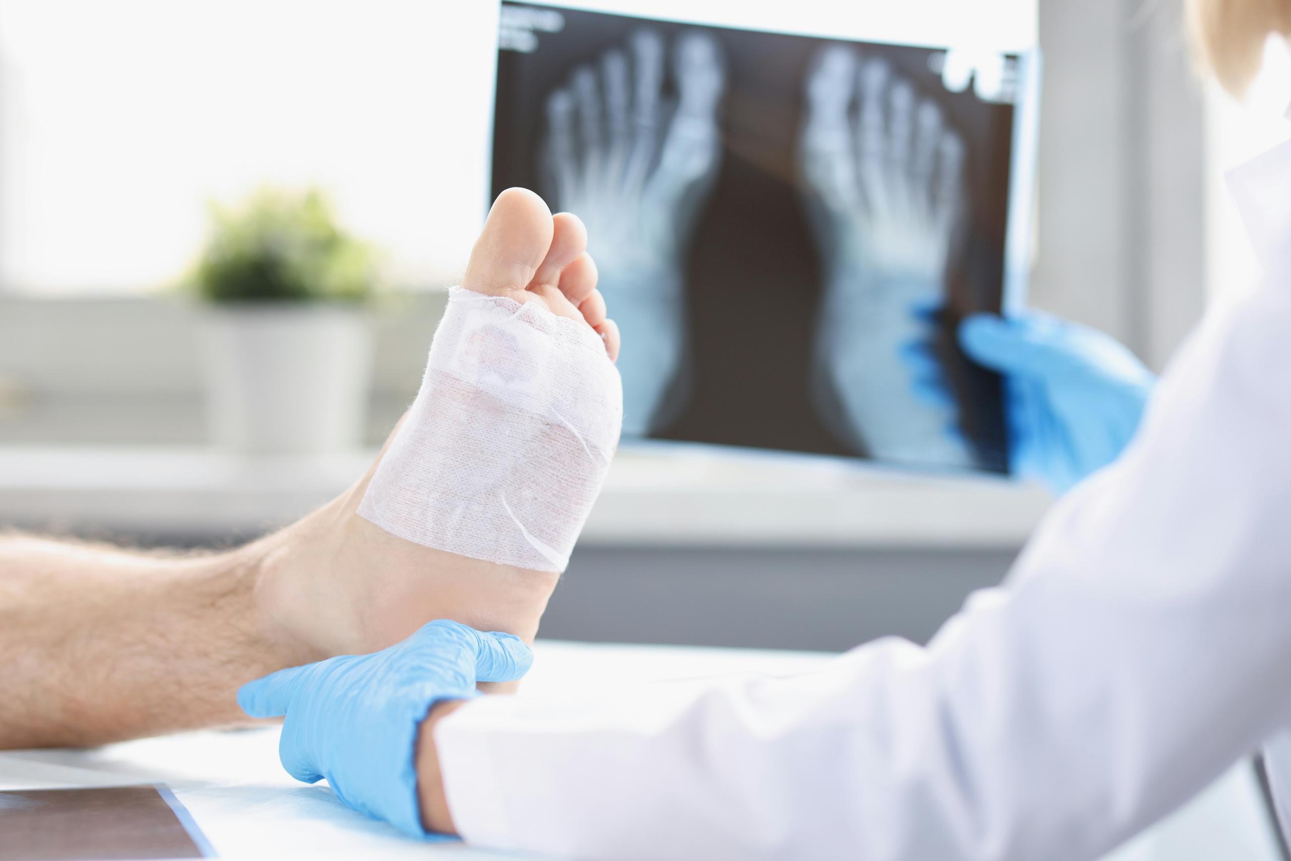 A close-up of a bandaged foot being supported by a gloved medical professional while another gloved hand holds up an X-ray image of feet in the background, creating a clinical setting focused on injury assessment and treatment.